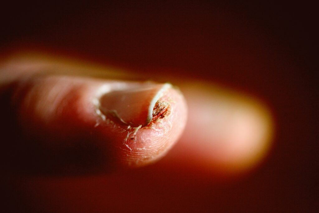 Potential Dangers of Having Mani-Pedis in Nail Salons 2 alexander grey PttD8yKQt0g unsplash 1