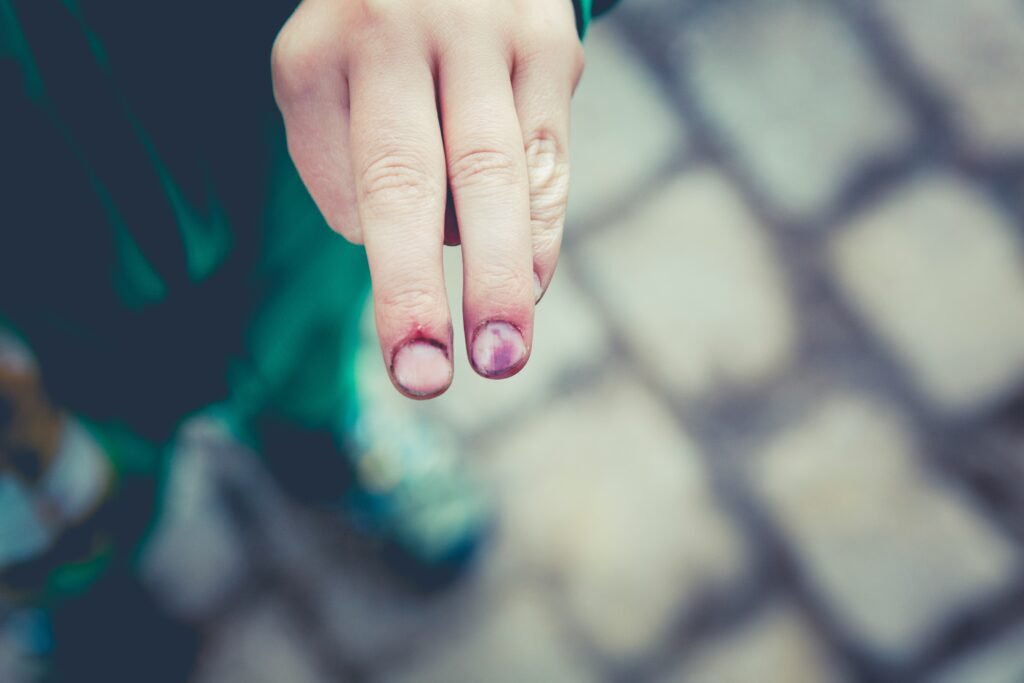 Simple Ways To Maintain Stronger And Healthier Nails 9 markus spiske htD3O0 fkGU unsplash